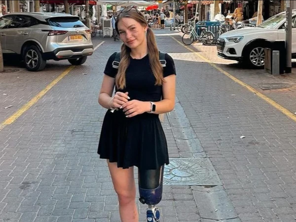 «Я не жертва обстоятельств». Одесситка, потерявшая ногу на войне, восхитила мир своими фото в Израиле
